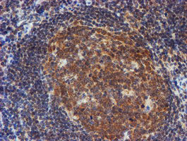 RUVBL2 Antibody in Immunohistochemistry (Paraffin) (IHC (P))