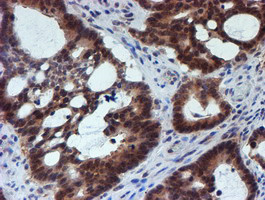 RUVBL2 Antibody in Immunohistochemistry (Paraffin) (IHC (P))