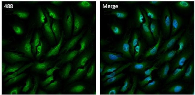 RAB11A Antibody in Immunocytochemistry (ICC/IF)