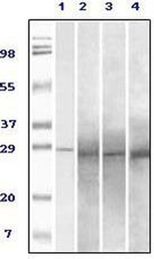 RAB25 Antibody in Western Blot (WB)