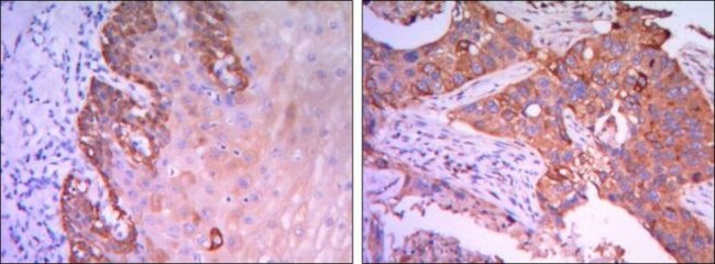 RAB25 Antibody in Immunohistochemistry (Paraffin) (IHC (P))