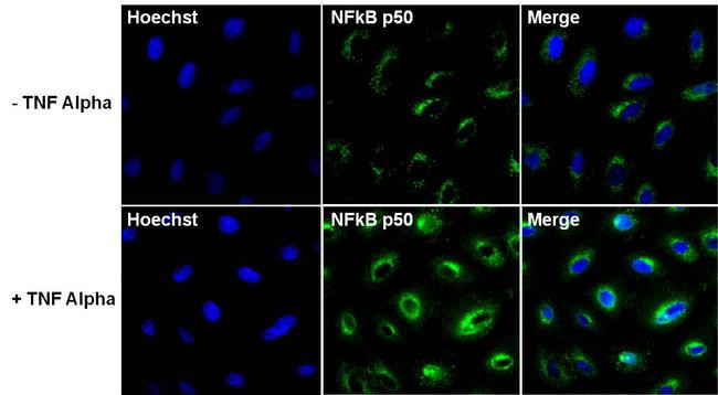 Rabbit IgG (H+L) Highly Cross-Adsorbed Secondary Antibody in Immunocytochemistry (ICC/IF)