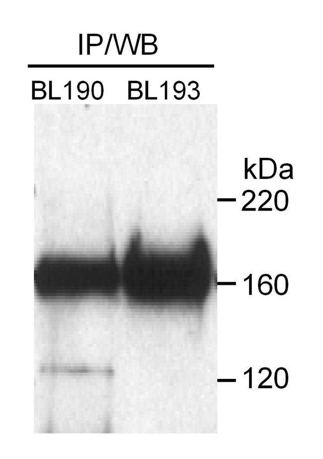 Rad50 Antibody in Western Blot (WB)