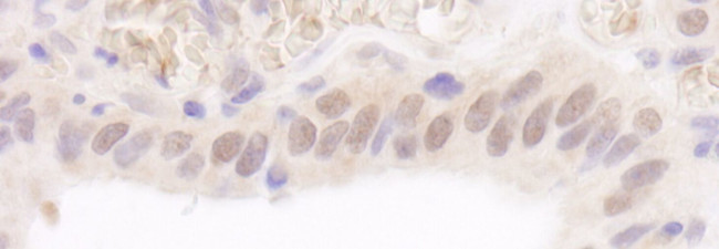 Rad6 Antibody in Immunohistochemistry (IHC)