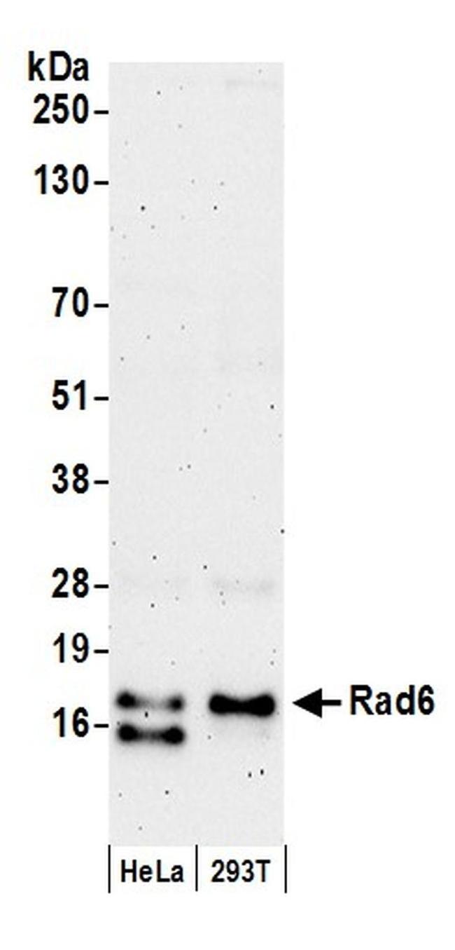 Rad6 Antibody in Western Blot (WB)