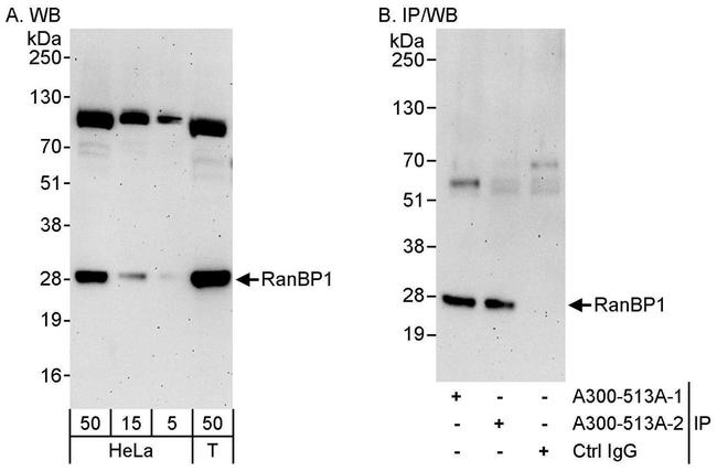 RanBP1 Antibody in Western Blot (WB)