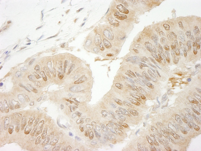 RanBP1 Antibody in Immunohistochemistry (IHC)