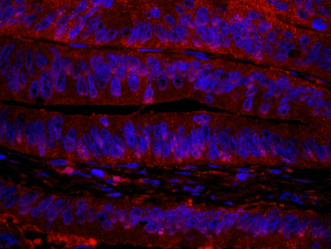 RanBP1 Antibody in Immunohistochemistry (IHC)