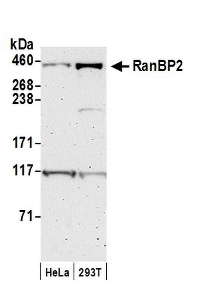 RanBP2 Antibody in Western Blot (WB)