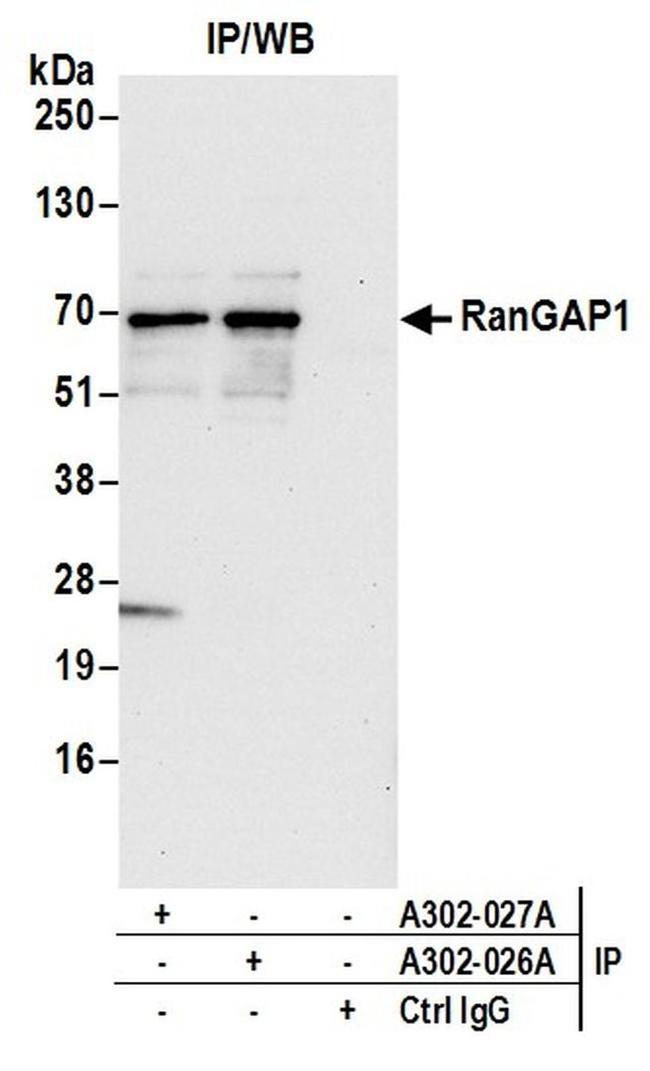 RanGAP1 Antibody in Western Blot (WB)