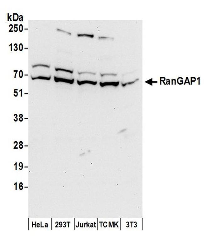 RanGAP1 Antibody in Western Blot (WB)