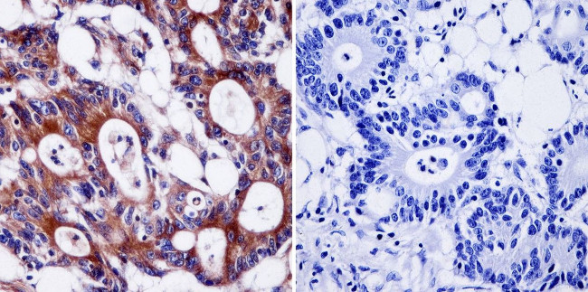 Pan Ras Antibody in Immunohistochemistry (Paraffin) (IHC (P))