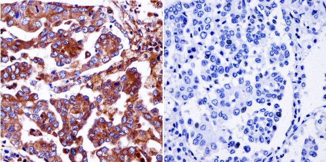 Pan Ras Antibody in Immunohistochemistry (Paraffin) (IHC (P))