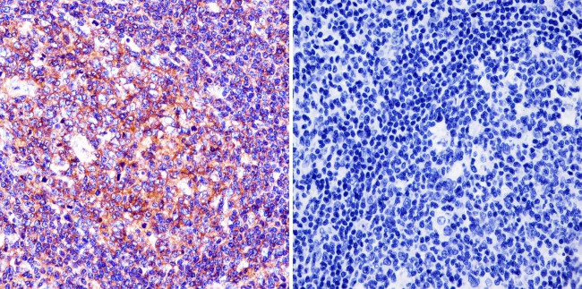 Pan Ras Antibody in Immunohistochemistry (Paraffin) (IHC (P))