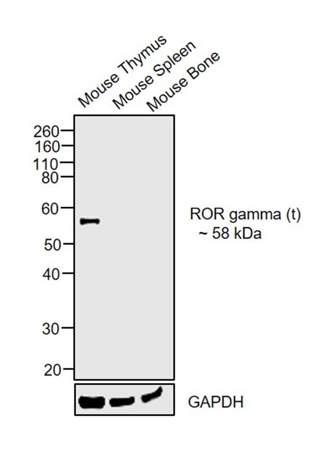 Rat IgG (H+L) Secondary Antibody in Western Blot (WB)