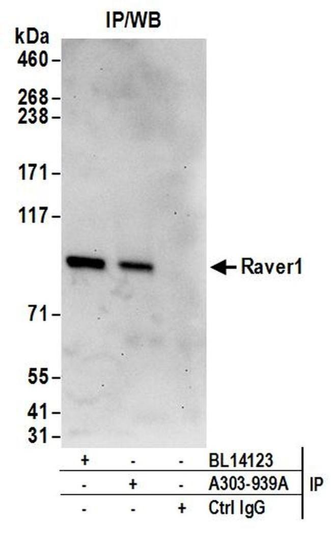 Raver1 Antibody in Western Blot (WB)