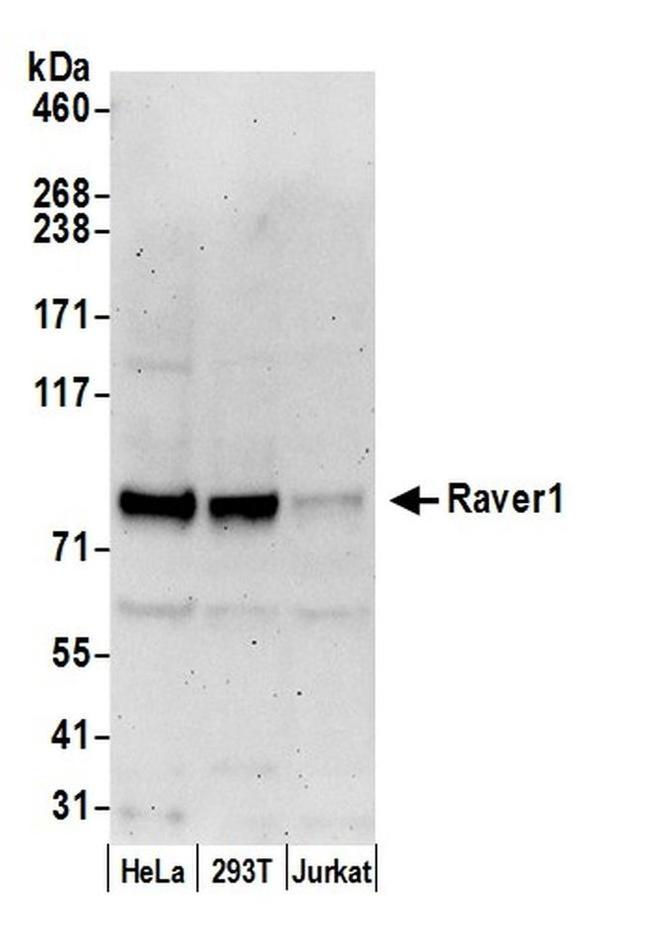 Raver1 Antibody in Western Blot (WB)