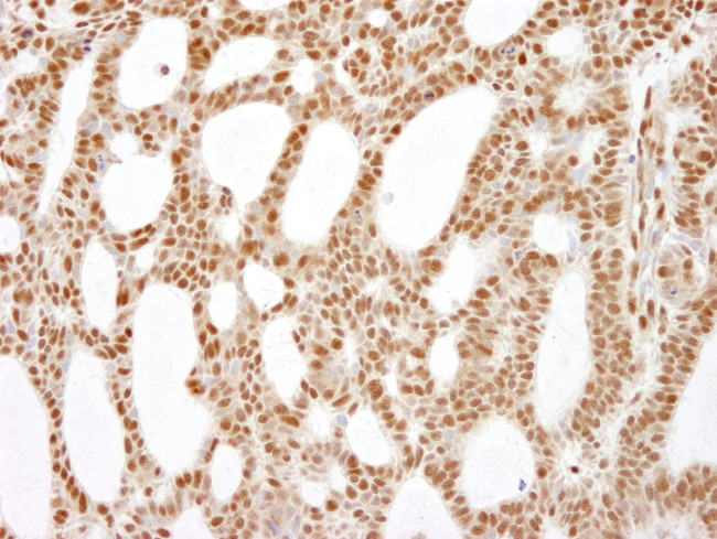 RecQ1 Antibody in Immunohistochemistry (IHC)