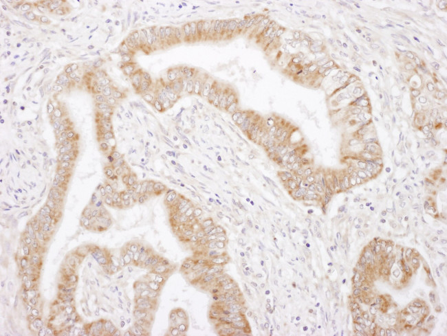 Rictor Antibody in Immunohistochemistry (IHC)