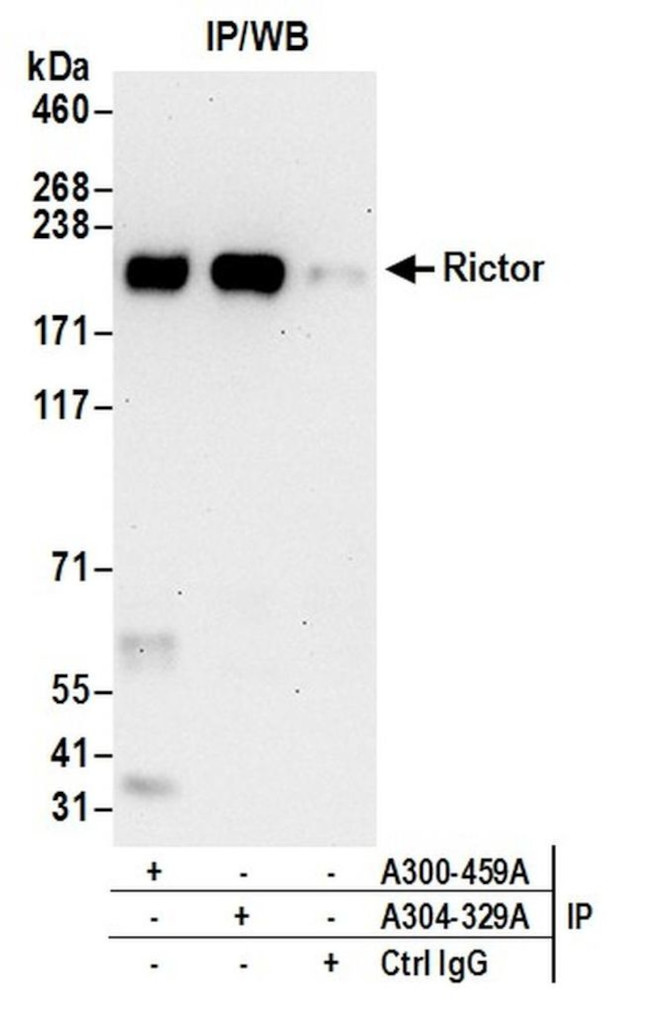 Rictor Antibody in Immunoprecipitation (IP)