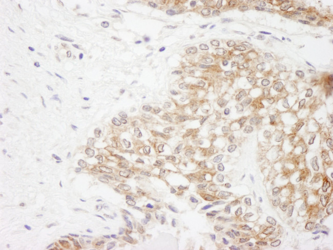 Rictor Antibody in Immunohistochemistry (IHC)