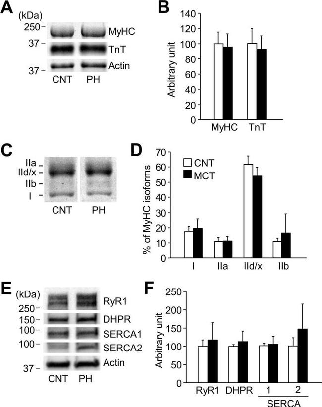 SERCA2 ATPase Antibody in Western Blot (WB)