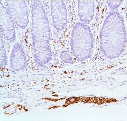 S100B Antibody in Immunohistochemistry (Paraffin) (IHC (P))