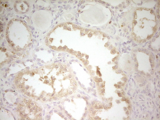 S100A1 Antibody in Immunohistochemistry (Paraffin) (IHC (P))