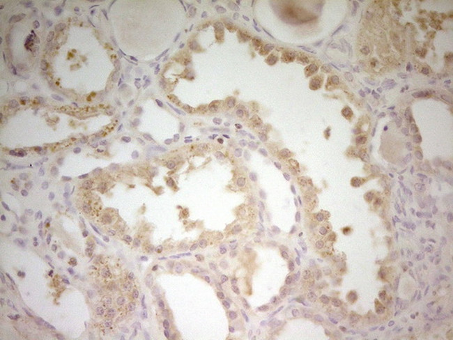 S100A1 Antibody in Immunohistochemistry (Paraffin) (IHC (P))