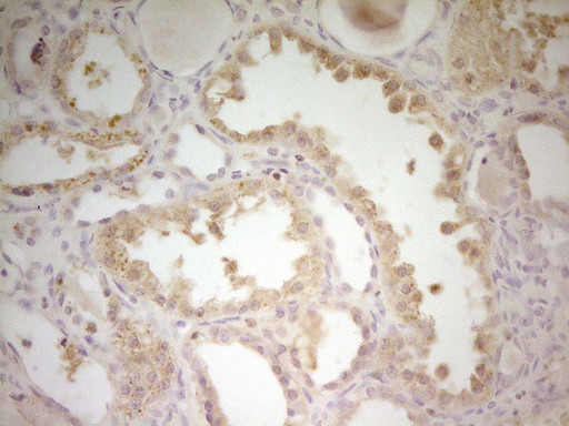 S100A1 Antibody in Immunohistochemistry (Paraffin) (IHC (P))