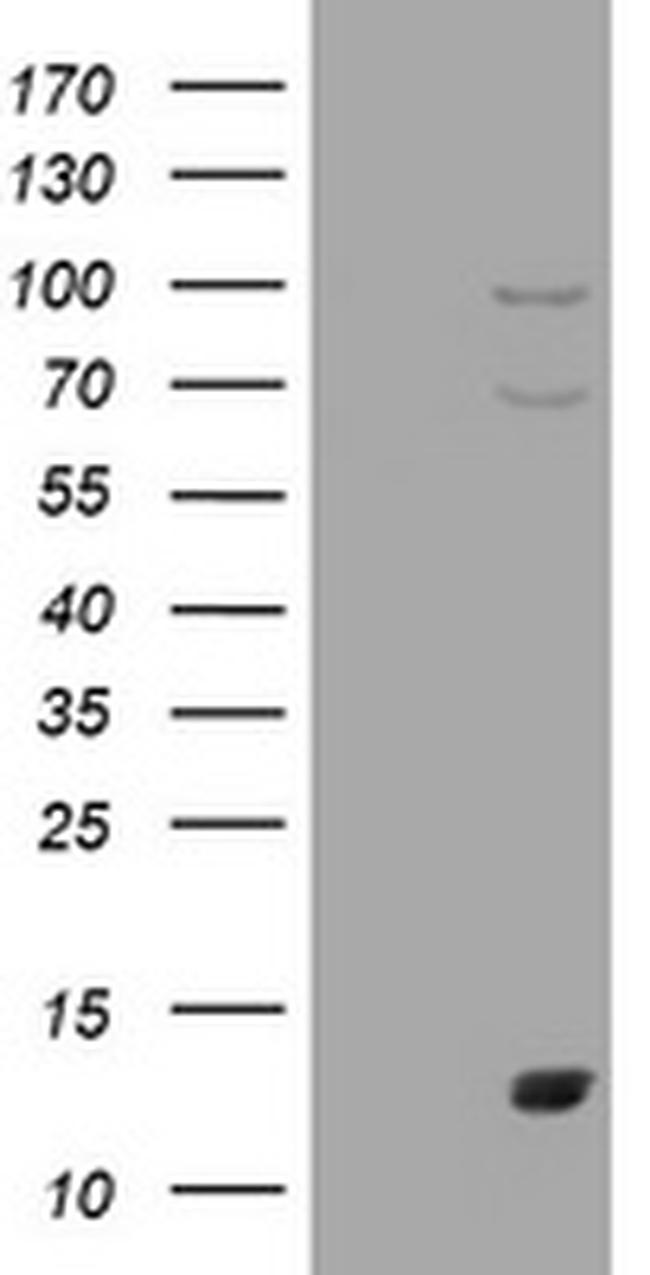 S100A1 Antibody in Western Blot (WB)