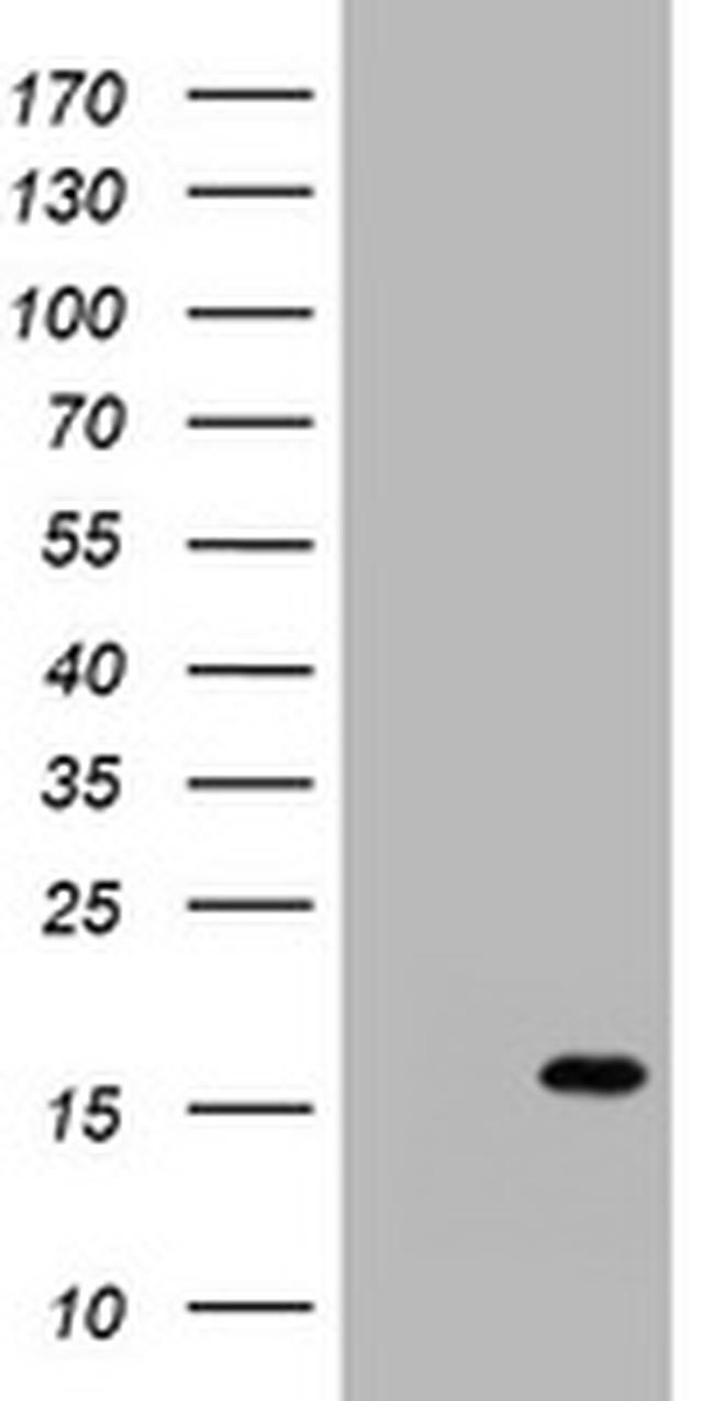 S100A1 Antibody in Western Blot (WB)