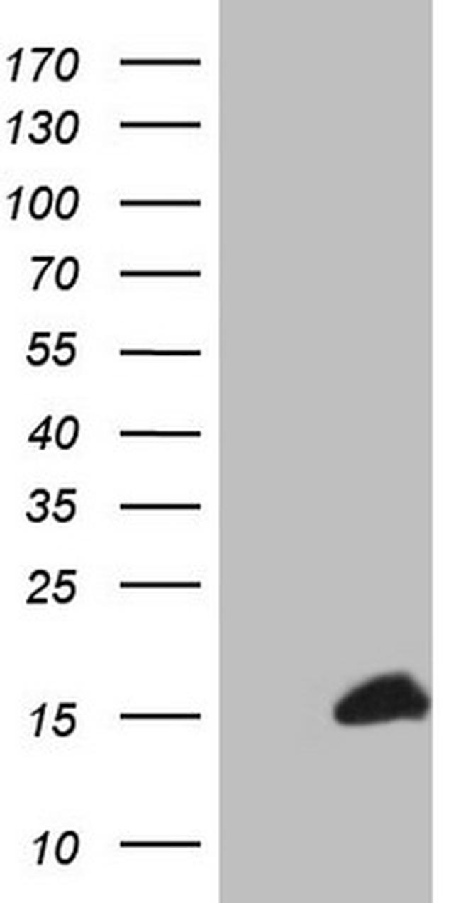 S100A1 Antibody in Western Blot (WB)