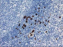 S100A12 Antibody in Immunohistochemistry (Paraffin) (IHC (P))