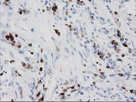 S100A12 Antibody in Immunohistochemistry (Paraffin) (IHC (P))