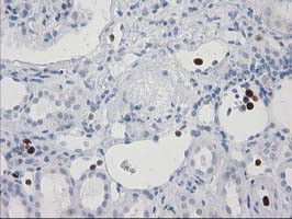 S100A12 Antibody in Immunohistochemistry (Paraffin) (IHC (P))