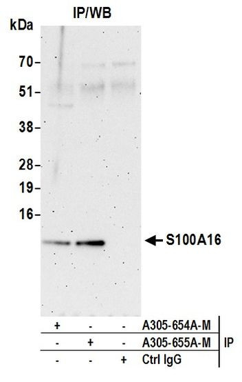 S100A16 Antibody in Immunoprecipitation (IP)