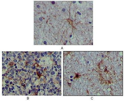 S100A1 Antibody in Immunohistochemistry (Paraffin) (IHC (P))