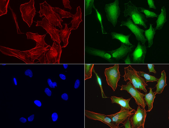 S100A9 Antibody in Immunocytochemistry (ICC/IF)