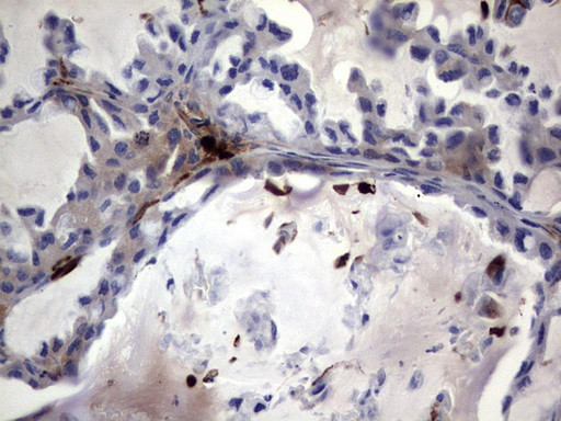 S100A9 Antibody in Immunohistochemistry (Paraffin) (IHC (P))