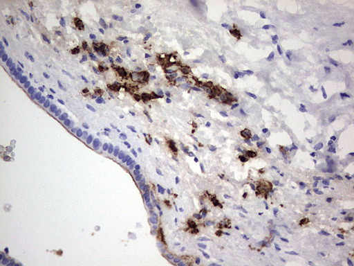 S100A9 Antibody in Immunohistochemistry (Paraffin) (IHC (P))