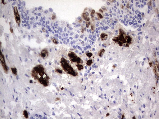 S100A9 Antibody in Immunohistochemistry (Paraffin) (IHC (P))