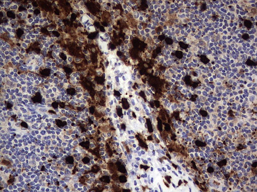 S100A9 Antibody in Immunohistochemistry (Paraffin) (IHC (P))