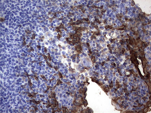 S100A9 Antibody in Immunohistochemistry (Paraffin) (IHC (P))