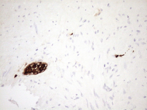 S100A9 Antibody in Immunohistochemistry (Paraffin) (IHC (P))