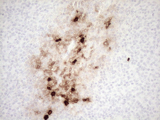 S100A9 Antibody in Immunohistochemistry (Paraffin) (IHC (P))