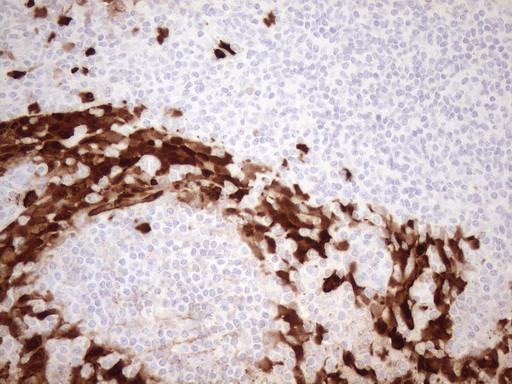 S100A9 Antibody in Immunohistochemistry (Paraffin) (IHC (P))