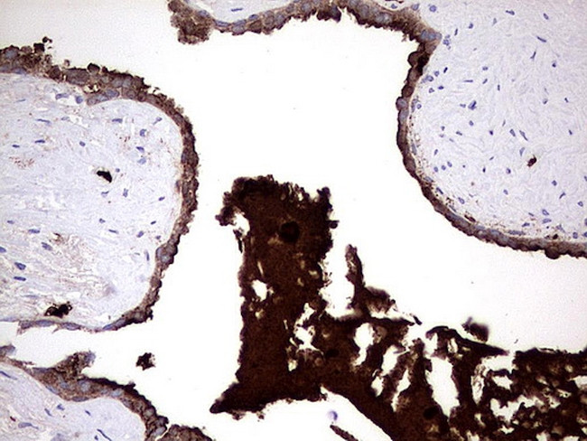 S100A9 Antibody in Immunohistochemistry (Paraffin) (IHC (P))