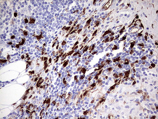 S100A9 Antibody in Immunohistochemistry (Paraffin) (IHC (P))