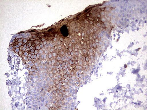 S100A9 Antibody in Immunohistochemistry (Paraffin) (IHC (P))